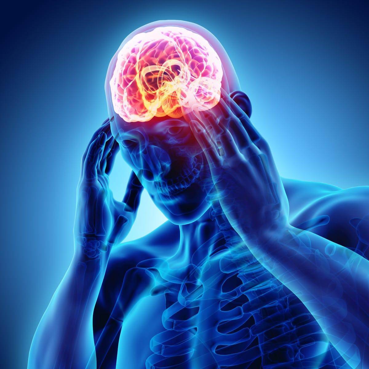 انواع سردرد - کدام سردرد خطرناک است