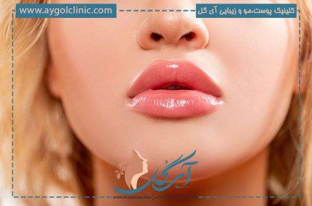 تزریق ژل لب مدل قلوه ای برای چه صورت های سازگاری دارد؟