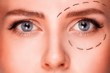 آیا بیرون زدگی چشم با تیروئید مرتبط است؟