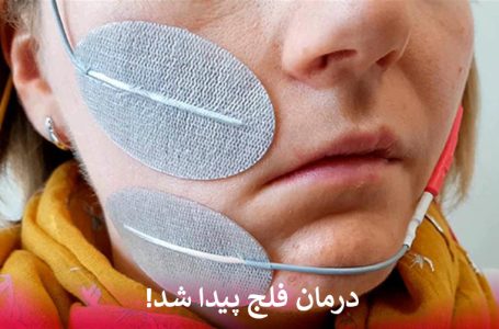درمان فلج