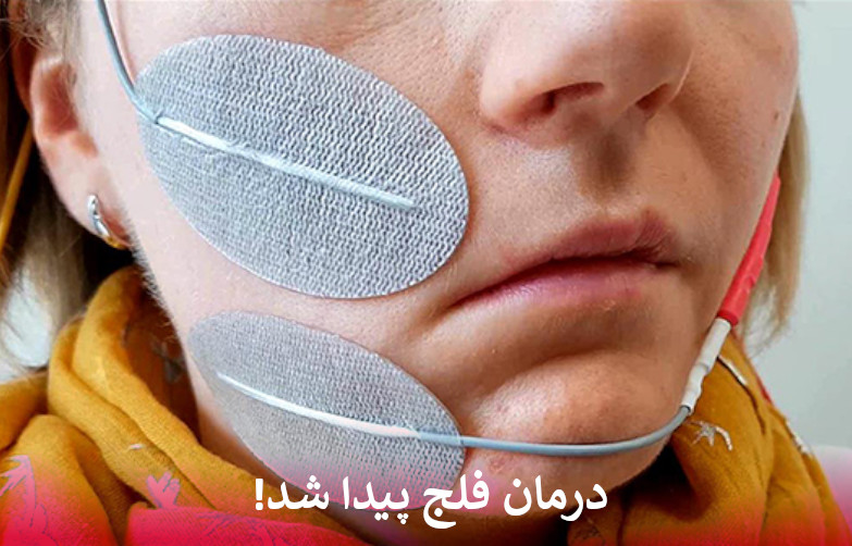 درمان فلج