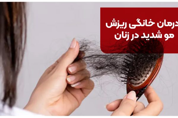درمان خانگی ریزش مو شدید در زنان با [+8 روش موثر]