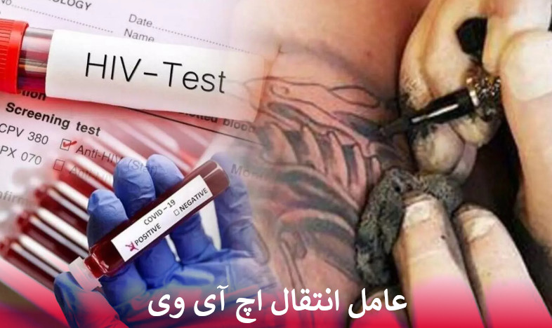 خطر انتقال اچ آی وی