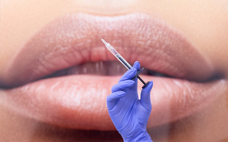 تزریق ژل لب