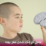 عامل کوچک شدن مغز بچه
