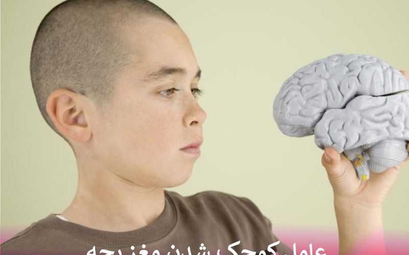 عامل کوچک شدن مغز بچه