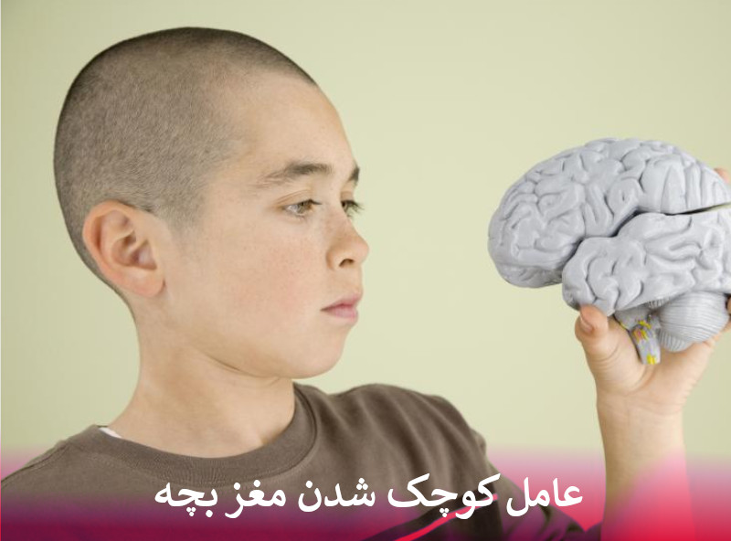 عامل کوچک شدن مغز بچه