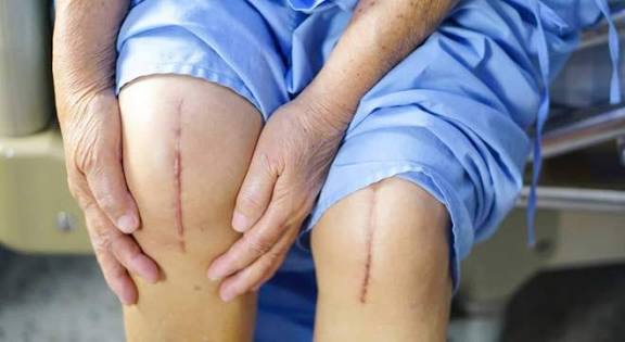 خطرات آمبولی بعد از عمل جراحی زانو