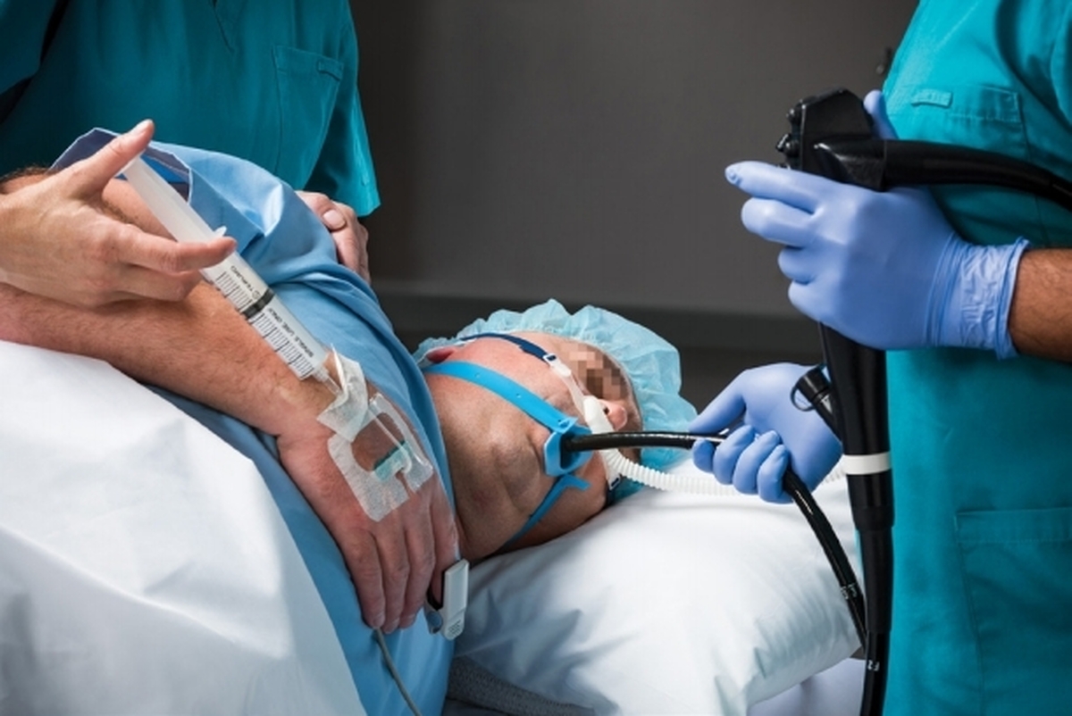 چه زمانی به آندوسکوپی نیاز است؟