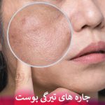 چاره های تیرگی پوست