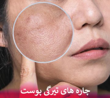 چاره های تیرگی پوست