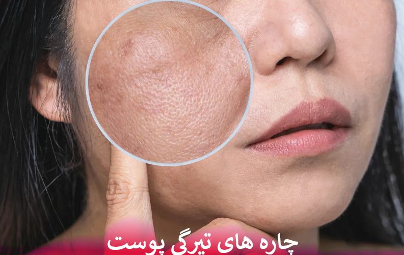چاره های تیرگی پوست