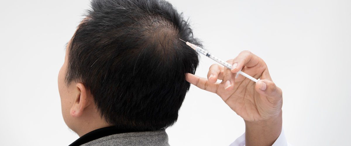 اگزوزوم تراپی مو؛ جدیدترین روش بازسازی و تقویت ریشه مو با نتایج ماندگار