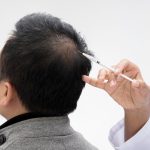 اگزوزوم تراپی مو؛ جدیدترین روش بازسازی و تقویت ریشه مو با نتایج ماندگار