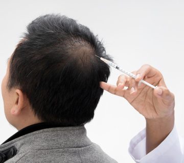 اگزوزوم تراپی مو؛ جدیدترین روش بازسازی و تقویت ریشه مو با نتایج ماندگار