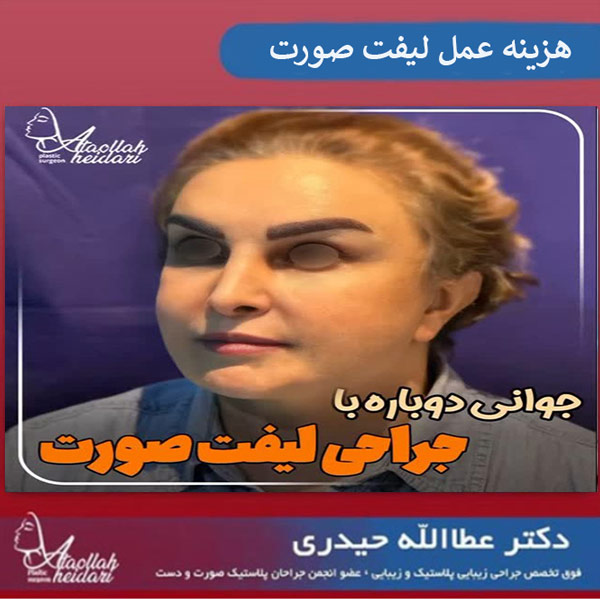شفاف سازی هزینه های عمل لیفت صورت