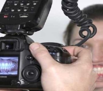 برای ارتودنسی چه عکس هایی لازم است؟