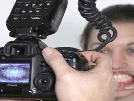 برای ارتودنسی چه عکس هایی لازم است؟