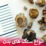 انواع سنگ های بدن