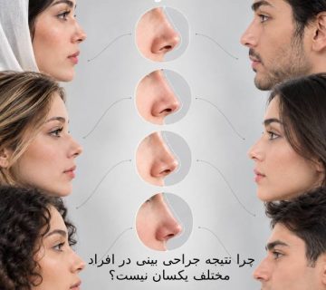 چرا نتیجه جراحی بینی در افراد مختلف یکسان نیست؟