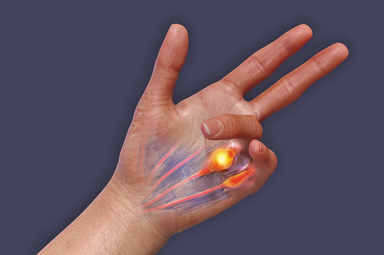 علائم آلزایمر در انگشت