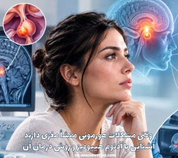 وقتی مشکلات هورمونی منشأ مغزی دارند؛ آشنایی با آدنوم هیپوفیز و روش درمان آن
