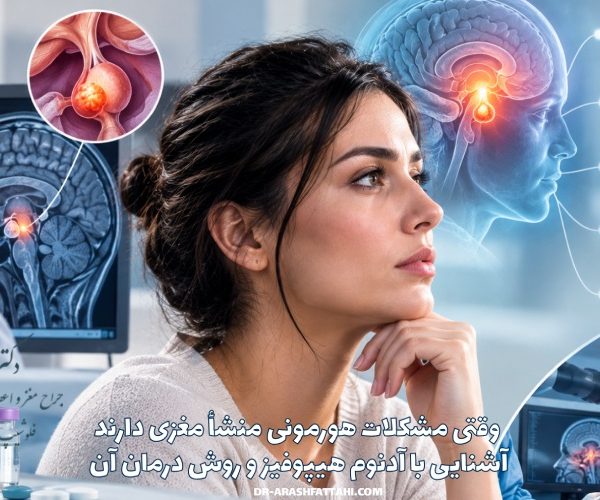 وقتی مشکلات هورمونی منشأ مغزی دارند؛ آشنایی با آدنوم هیپوفیز و روش درمان آن