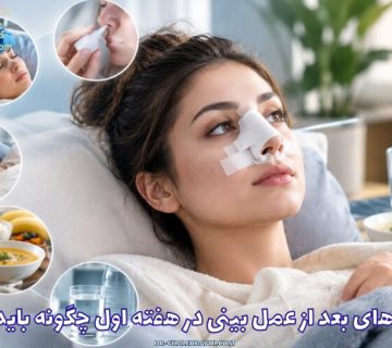 مراقبت‌های بعد از عمل بینی در هفته اول چگونه باید باشد؟