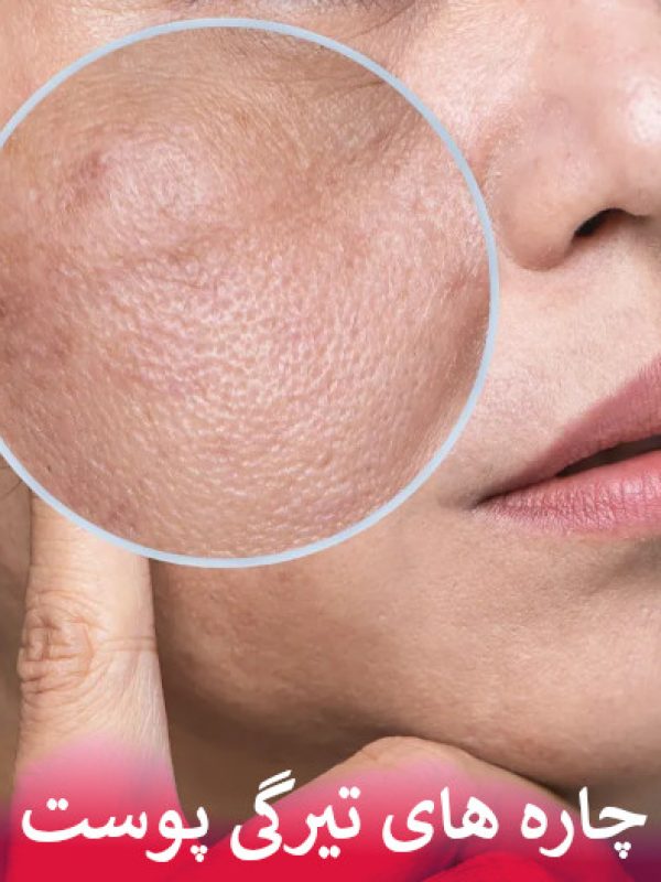 چاره های تیرگی پوست