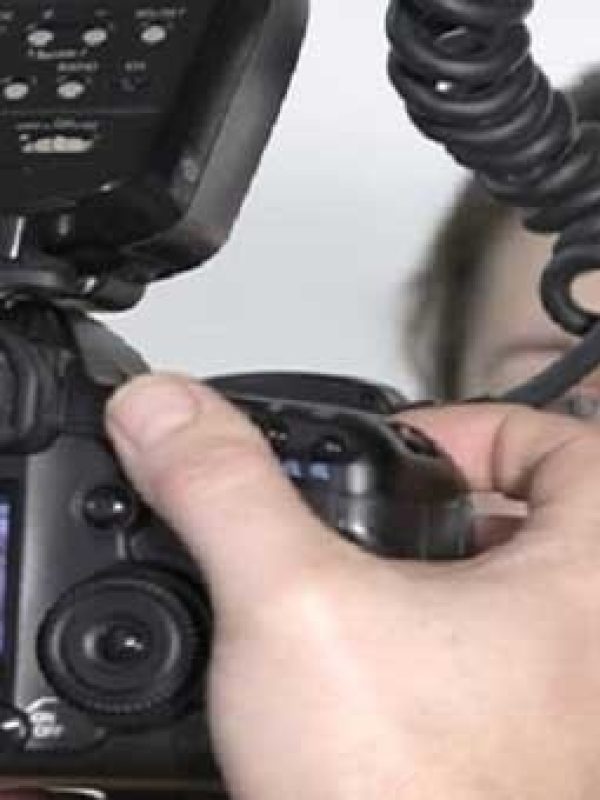 برای ارتودنسی چه عکس هایی لازم است؟