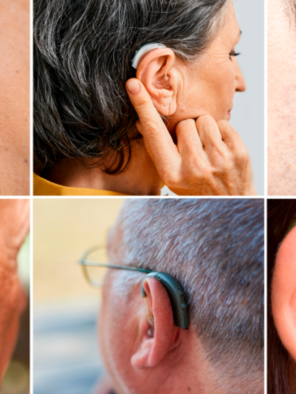 مقایسه سمعک‌های باتری‌خور و شارژی: کدام یک برای شما مناسب‌تر است؟